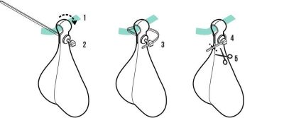 Задний велосипедный фонарик Hornit Bike Balls BB